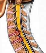Herniated Disc Beverly Hills